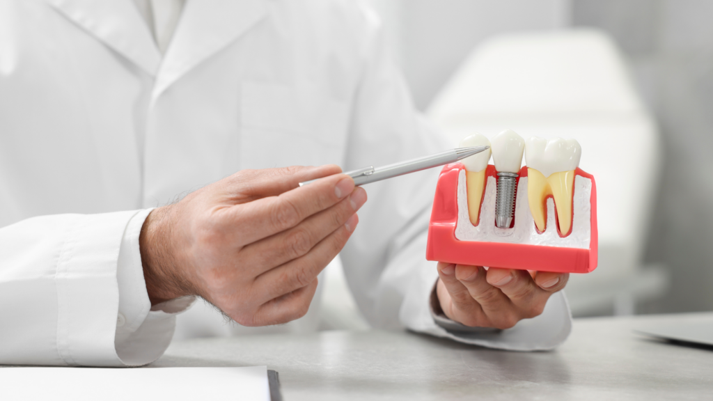 Metal Dental Implants: Understanding Allergic Reactions and Your Options