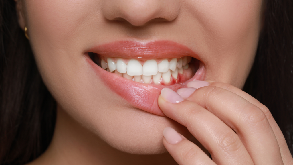 Top 4 Signs of Gum Disease: What You Need to Know